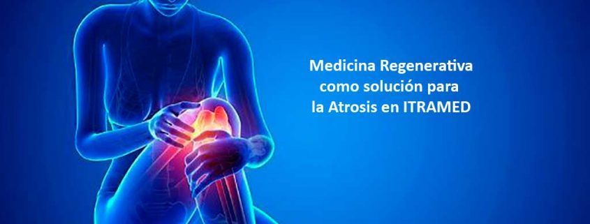 Medicina regenerativa para la artrosis en ITRAMED