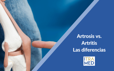 La Artrosis y la Artritis, ¿Qué es?