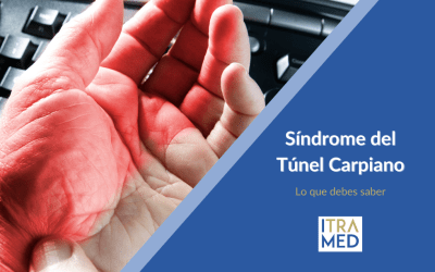 Síndrome del Túnel Carpiano