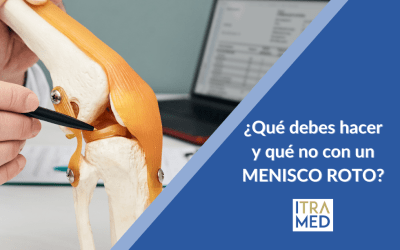 Tengo el menisco roto, ¿Qué actividades puedo hacer?
