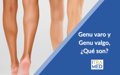 Genu Varo y Genu Valgo: Cómo afectan a tus rodillas