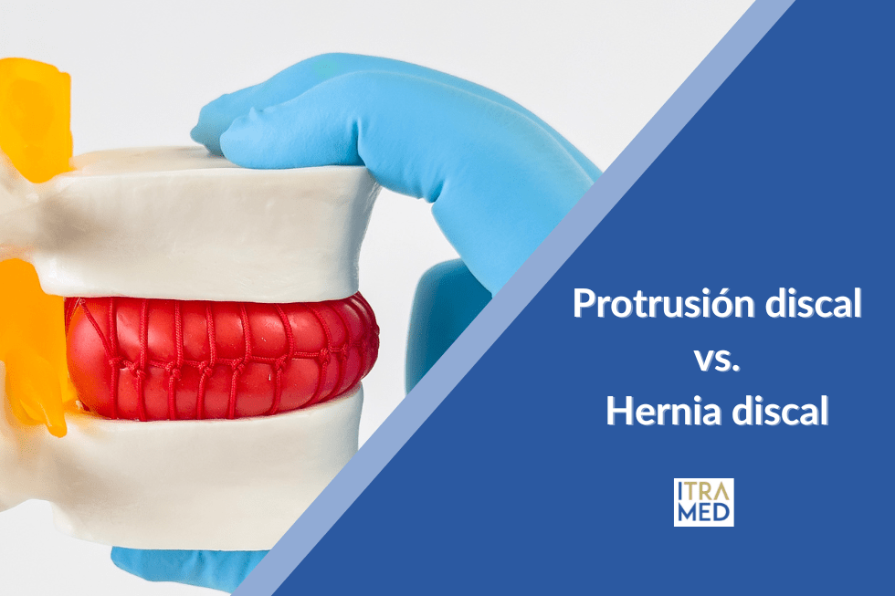 Protrusión discal vs. hernia discal: diferencias clave y tratamientos sin cirugía