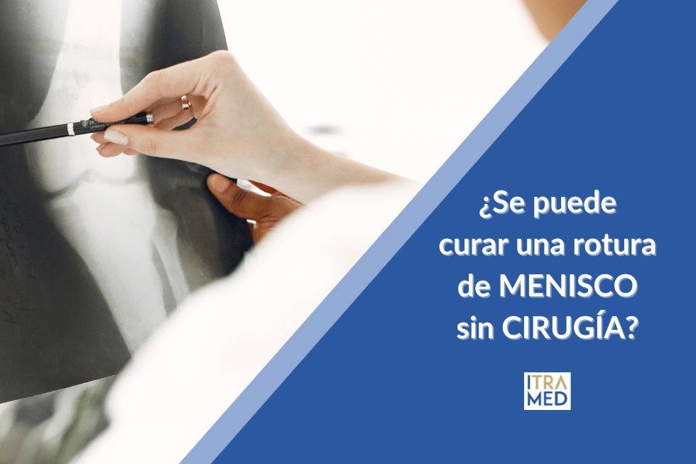 ¿Se puede curar una rotura de menisco sin cirugía?